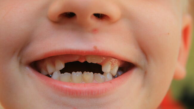 Безплатни стоматологични процедури за деца