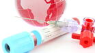 Трима нови със СПИН в Русе, тече профилактика