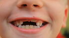 Троянските зъболекари най-активни в безплатните прегледи
