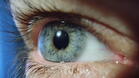 Безплатни прегледи за глаукома