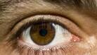 Плевен се включва в Световната седмица на глаукомата